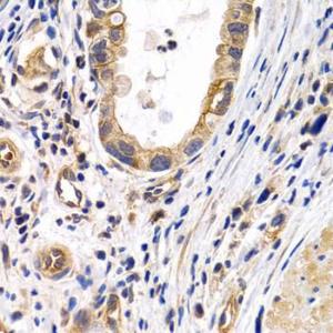 Anti-Prostacyclin receptor Rabbit Polyclonal Antibody