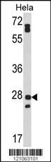 Anti-FCGR3A Rabbit Polyclonal Antibody