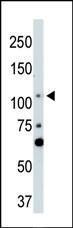 Anti-LATS2 Rabbit Polyclonal Antibody (HRP (Horseradish Peroxidase))