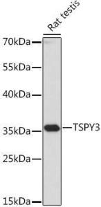 Western blot analysis of extracts of Rat testis, using Anti-TSPY3 Antibody (A307695) at 1:1,000 dilution. The secondary antibody was Goat Anti-Rabbit IgG H&L Antibody (HRP) at 1:10,000 dilution.