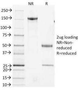 SDS-PAGE analysis of Anti-CD3 epsilon Antibody [145-2C11] under non-reduced and reduced conditions; showing intact IgG and intact heavy and light chains, respectively. SDS-PAGE analysis confirms the integrity and purity of the Antibody