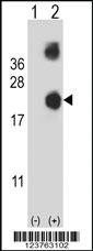 Anti-DSTN Rabbit Polyclonal Antibody