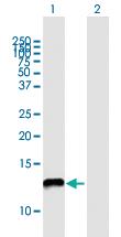 Anti-NDUFA5 Mouse Polyclonal Antibody