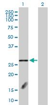 Anti-FBXL18 Rabbit Polyclonal Antibody