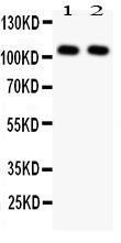 Anti-NFkB p105/p50 Rabbit Antibody