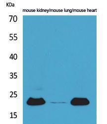 Western blot analysis of mouse kidney, mouse lung, mouse heart cells using Anti-ADM Antibody