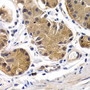 Anti-Prostacyclin receptor Rabbit Polyclonal Antibody