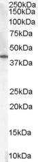 Anti-HSD3B1 Antibody (A84203) (001 µg/ml) staining of Human Placenta lysate (35 µg protein in RIPA buffer) Primary incubation was 1 hour Detected by chemiluminescence