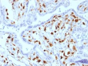 Immunohistochemical analysis of formalin-fixed, paraffin-embedded human placenta using Anti-Factor XIIIa Antibody [SPM180]