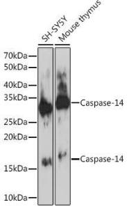 Western blot analysis of extracts of various cell lines, using Anti-Caspase-14 Antibody [ARC1661] (A305978) at 1:1,000 dilution. The secondary antibody was Goat Anti-Rabbit IgG H&L Antibody (HRP) at 1:10,000 dilution.