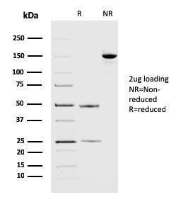 SDS-PAGE analysis of Anti-PD-L2 Antibody [PDL2/2676] under non-reduced and reduced conditions; showing intact IgG and intact heavy and light chains, respectively. SDS-PAGE analysis confirms the integrity and purity of the antibody