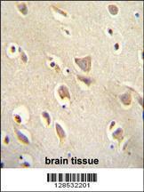 Anti-MCHR1 Rabbit Polyclonal Antibody (APC (Allophycocyanin))