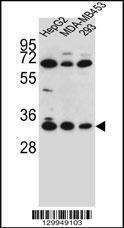 Anti-OR2T3 Rabbit Polyclonal Antibody (AP (Alkaline Phosphatase))