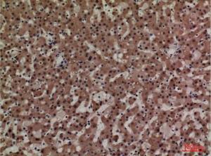 Immunohistochemical analysis of paraffin-embedded human liver using Anti-ADM Antibody