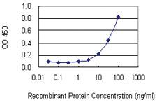 Anti-SP140 Mouse Monoclonal Antibody [clone: 3F9]