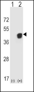 Anti-PGK1 Rabbit Polyclonal Antibody (HRP (Horseradish Peroxidase))