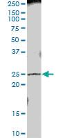 Anti-PRTFDC1 Mouse Polyclonal Antibody