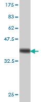 Anti-PRKAR2A Mouse Monoclonal Antibody [clone: 6A9]