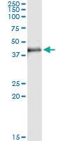 Anti-MAD2L1BP Antibody Pair