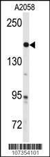 Anti-ABL2 Rabbit Polyclonal Antibody (Biotin)