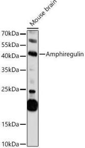 Western blot analysis of extracts of Mouse brain, using Anti-Amphiregulin Antibody (A11487) at 1:1,000 dilution The secondary antibody was Goat Anti-Rabbit IgG H&L Antibody (HRP) at 1:10,000 dilution Lysates/proteins were present at 25 µg per lane