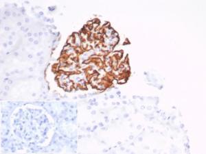 Immunohistochemical analysis of formalin-fixed, paraffin-embedded human kidney tissue using Anti-CD35 Antibody [CR1/7016R] at 2µg/ml. Inset: PBS instead of the primary antibody. Secondary antibody negative control.