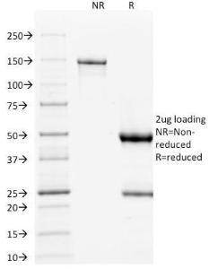 SDS-PAGE analysis of Anti-p53 Antibody [DO-1] under non-reduced and reduced conditions; showing intact IgG and intact heavy and light chains, respectively. SDS-PAGE analysis confirms the integrity and purity of the antibody.