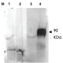 Anti-FAP Rabbit Polyclonal Antibody