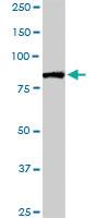 Anti-FBXL18 Rabbit Polyclonal Antibody