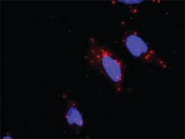 Anti-ARAF + BRAF Antibody Pair