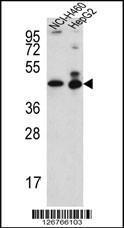 Anti-ACTL6B Rabbit Polyclonal Antibody (Biotin)