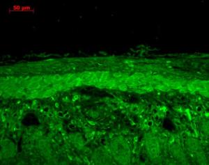 Immunohistochemistry analysis of mouse backskin, fixed in Bouin's fixative solution