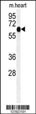 Anti-FOXK1 Rabbit Polyclonal Antibody