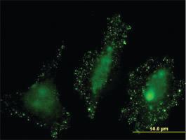 Anti-PKN2 Mouse Monoclonal Antibody [clone: 3A7]