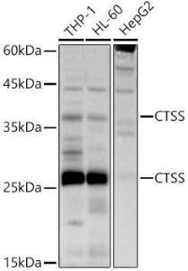 Anti-Cathepsin S Rabbit Polyclonal Antibody