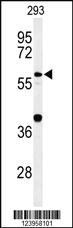 Anti-CDC45 Rabbit Polyclonal Antibody