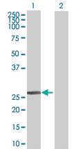 Anti-DCXR Mouse Polyclonal Antibody