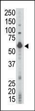 Anti-LCK Rabbit Polyclonal Antibody (PE (Phycoerythrin))