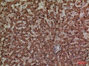 Immunohistochemical analysis of paraffin-embedded human liver using Anti-ADM Antibody