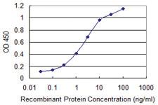 Anti-CK75 Mouse Monoclonal Antibody [clone: 3F9]