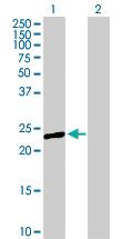 Anti-PRTFDC1 Mouse Polyclonal Antibody