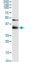 Anti-SULT1B1 Rabbit Polyclonal Antibody