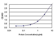 Anti-CASQ2 Antibody Pair