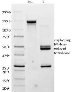 SDS-PAGE analysis of Anti-P Cadherin Antibody [12H6] under non-reduced and reduced conditions; showing intact IgG and intact heavy and light chains, respectively. SDS-PAGE analysis confirms the integrity and purity of the antibody