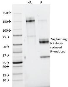 SDS-PAGE analysis of Anti-Nidogen Antibody [ELM1] under non-reduced and reduced conditions; showing intact IgG and intact heavy and light chains, respectively SDS-PAGE analysis confirms the integrity and purity of the antibody