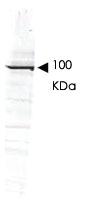 Anti-GGA1 Rabbit Polyclonal Antibody