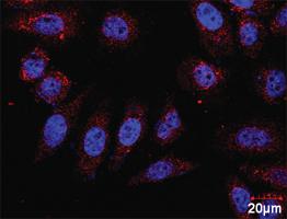 Anti-AKT1 + BAD Antibody Pair