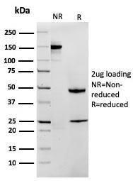 SDS-PAGE analysis of Anti-MTAP Antibody [MTAP/1813] under non-reduced and reduced conditions; showing intact IgG and intact heavy and light chains, respectively. SDS-PAGE analysis confirms the integrity and purity of the antibody