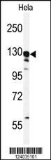 Anti-OR4Q3 Rabbit Polyclonal Antibody