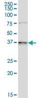 Anti-ATOH8 Rabbit Polyclonal Antibody